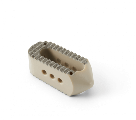 Calix-P PC