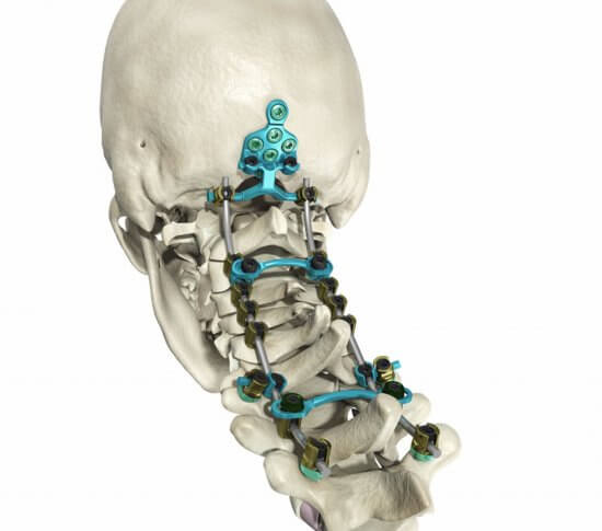 1---streamline_oct_anatomy_small