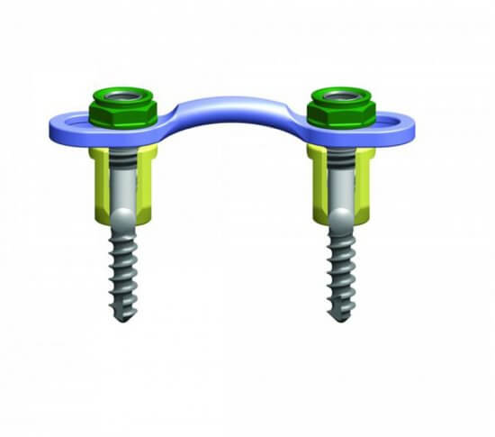 2---Streamline_OCT_Head-to-Head_Crosslink-768x593