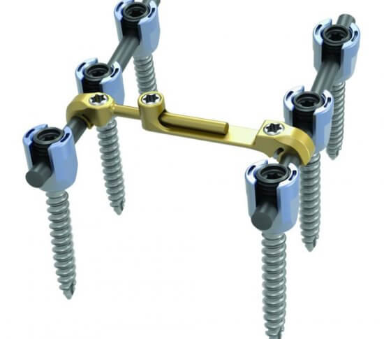 2---Streamline_TL_with_Crosslink-768x768