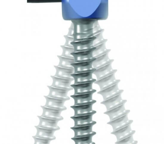 3---Streamline_TL_Composite_Screw-768x1140